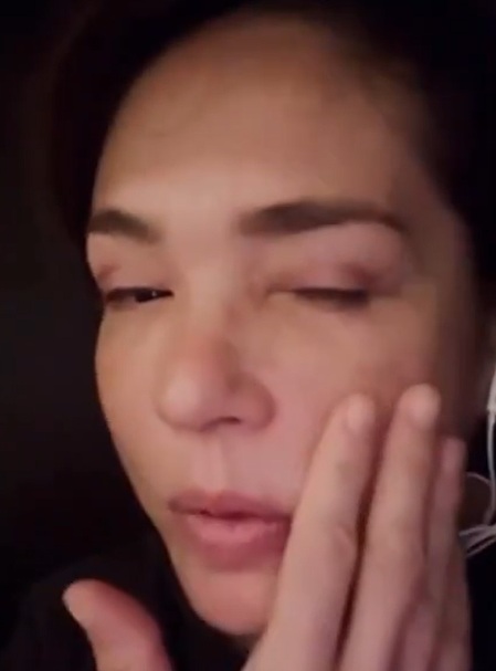 Deterioro físico de Yolanda Andrade