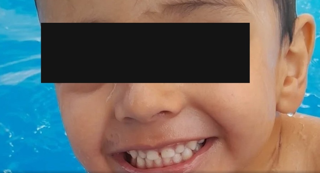 Niño muere durante cirugía; médico estaba con el celular