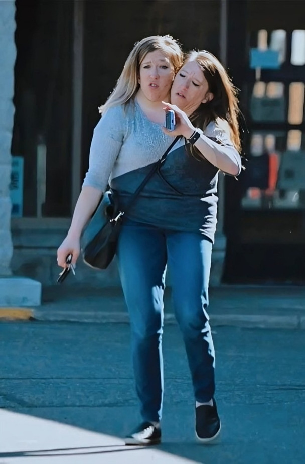 ¿Qué pasó con las siamesas Abby y Brittany Hensel?