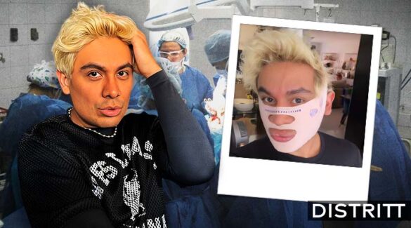 Ricardo Peralta se somete a nueva cirugía estética; así luce