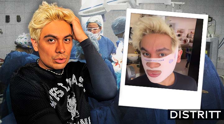 Ricardo Peralta se somete a nueva cirugía estética; así luce