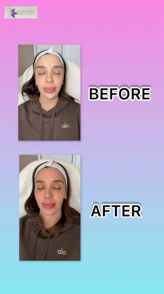 Antes y después de Emma Coronel