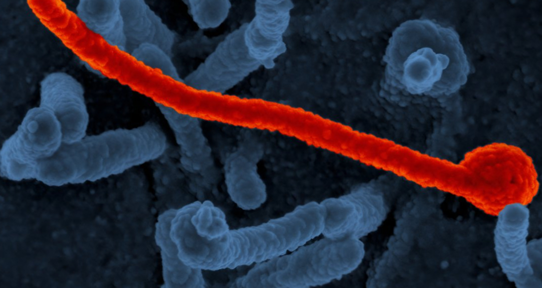 ¿Qué es Ébola y cuáles son sus síntomas?