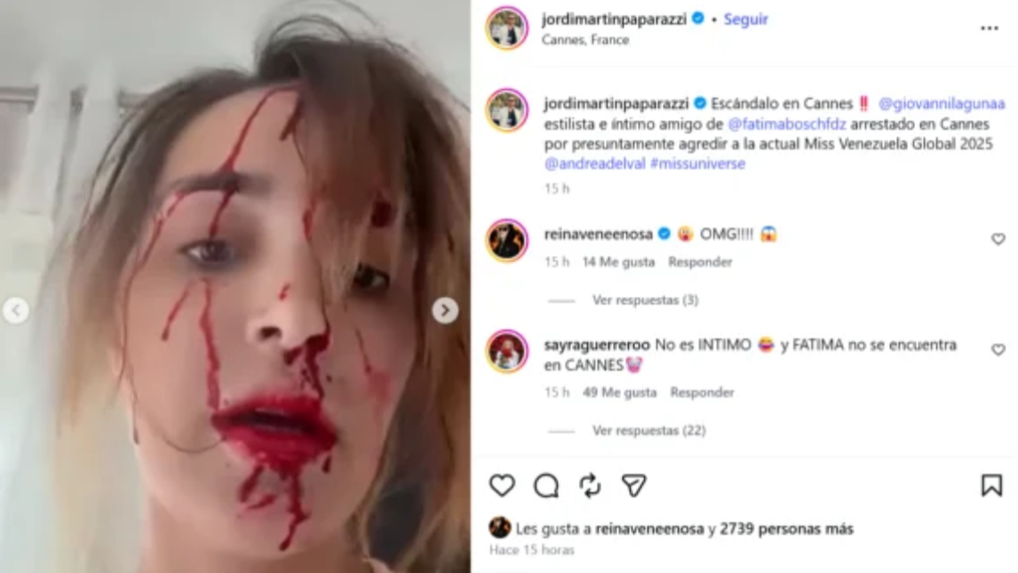 Andrea de Val aparece con el rostro ensangrentado