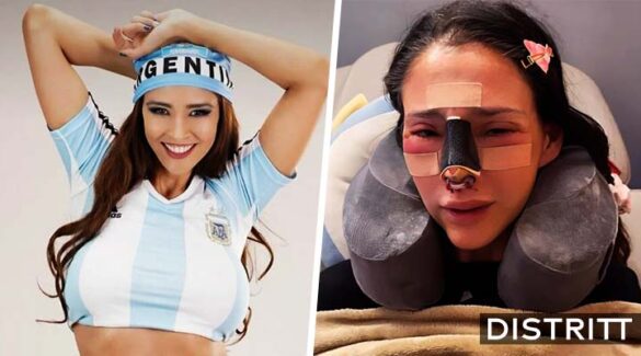 ¿Qué pasó con Dorismar, modelo que se desfiguró el rostro?