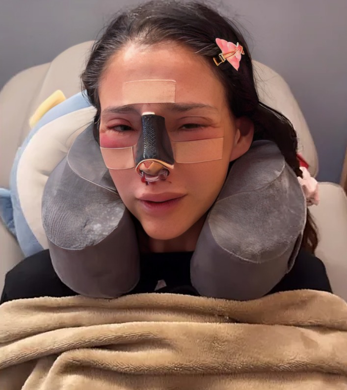 ¿Qué pasó con Dorismar, modelo que se desfiguró el rostro?