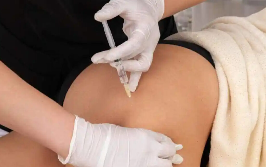 ¿Se puede vivir con biopolímeros en los glúteos? 