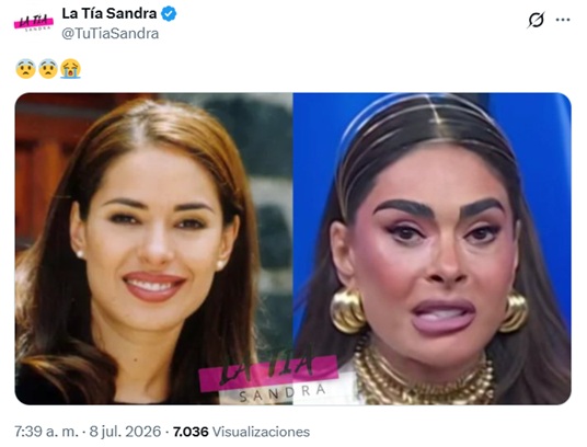 ¿Qué le pasó en el rostro a Galilea Montijo?