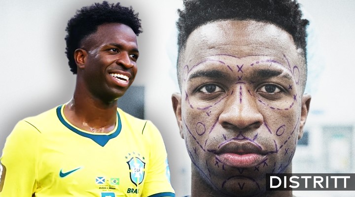 Nueva apariencia de Vinicius Jr con cirugía facil |VIDEO